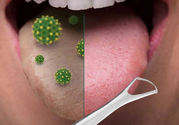 تمیز کننده زبان