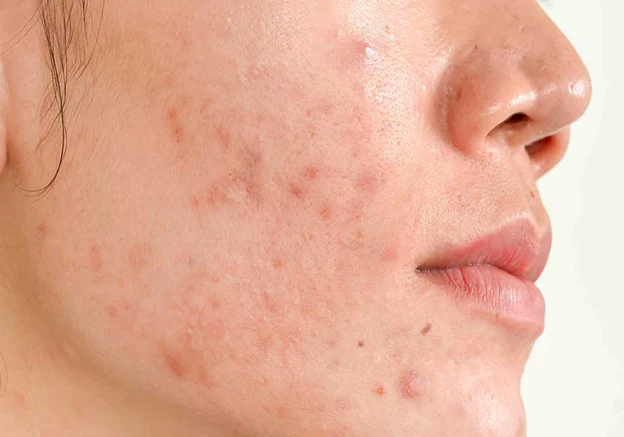 ژل صورت درموبای