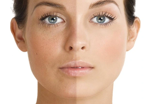 قرص پیگمنتا