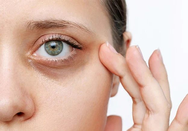 کرم دور چشم درموبای